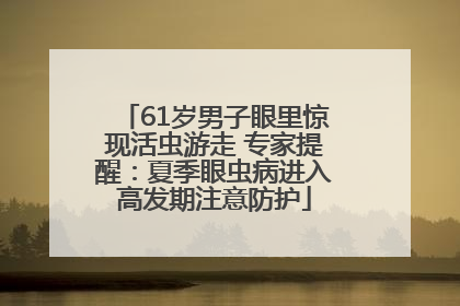 61岁男子眼里惊现活虫游走 专家提醒：夏季眼虫病进入高发期注意防护
